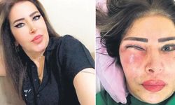 Yüz gerdirme ameliyatı sonrası hayatı kabusa döndü! İstanbul'da estetik faciası