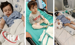 Anestezi Sonrası Kalbi Duran Minik Alper Entübe Edildi