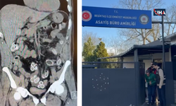 Fas’tan İstanbul’a Şok Olay: Midesinden Yasaklı Madde Çıkarıldı