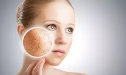 Uzmanlar Açıkladı: Kışın Cilt Kuruluğunun Nedeni