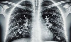 Uzmanlar Uyardı: Kışın Enfeksiyon Artışı Doğal, Hijyen Şart