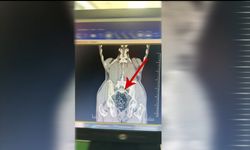 Yolcunun Midesinde 472 Gram Metamfetamin Bulundu