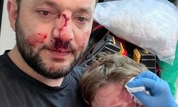 Skuter ‘Silah’ Kabul Edildi, İkra Davasında İddianame