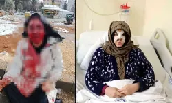Nazlı, Eşi Tarafından Dövüldü: Çıkarsa Yarım Kalanı Tamamlayacak