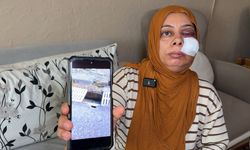 Elektrikli Bisiklet Sürerken Rögar Çukuruna Düştü:Yüzüne 14 Dikiş Atıldı