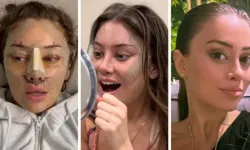 İstanbul Esenyurt’ta Yüz Gerdirme Ameliyatı Sonrası Ölüm İddiası: İhmaller Sorgulanıyor