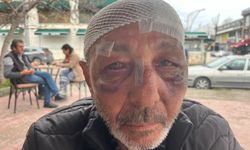 Çakmak İsteği Üzerine Sokakta Gerginlik Çıktı