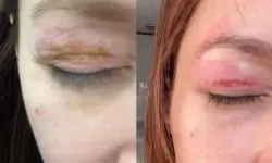 Güzellik Salonundaki İşlem Şikayeti Sonuçsuz Kaldı