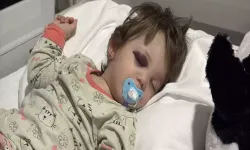 Yalova'da Çocuk Annesinin Kucağından Düştü, Baba Burnundaki Kanı Akıttı