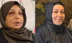 Eşini Yaralayan Polis Memurunun Dosyası Ağır Cezaya Gönderildi