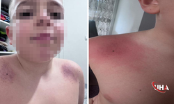 Darp İddiasıyla Öğretmen Hakkında Yasal İşlem Başlatıldı