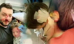 Kucağındaki Bebeğiyle Darbedilen Baba'nın Oğlunu Taşla Yaraladılar