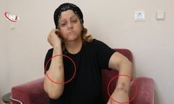 Diyarbakır’da Kan Donduran Pusu: 30 Bıçak Darbesine Rağmen Hayata Tutundu