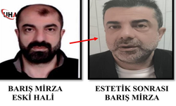 Yüzünü Değiştirdi, Kaderini Değiştiremedi: Firari Yakalandı