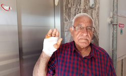 Komşusunun Isırdığı Serçe Parmağı Ampute Edildi