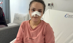 Alkollü Koca Karısının Burnunu Isırarak Kopardı