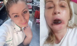 Estetik Operasyon Mağduriyeti: Songül Uzunoğlu'nun 7 Yıllık Adalet Arayışı