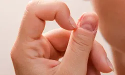 Tırnaklardaki Kırmızı Lunulae Belirtisine Dikkat