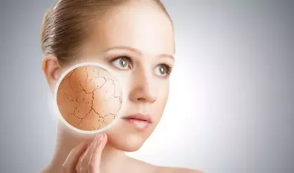 Uzmanlar Açıkladı: Kışın Cilt Kuruluğunun Nedeni