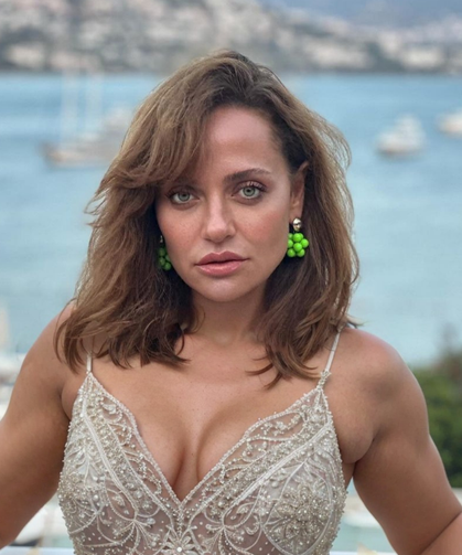 Ünlü Oyuncu Didem Balçın'dan Estetik İtirafı