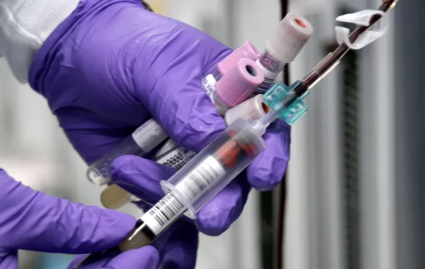 Daha Hızlı Yaşlanıyor Olabilir Misiniz? Cevap Kanınızda Saklı