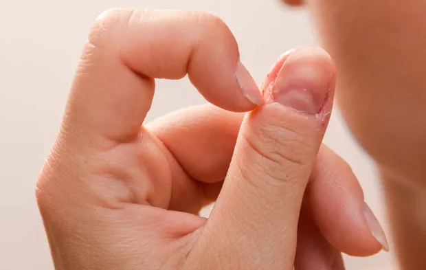 Tırnaklardaki Kırmızı Lunulae Belirtisine Dikkat