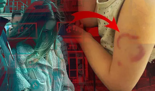 Kan Donduran Olay! Baba  Çocuğu Ağlayınca Fark Etti