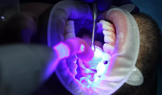 Ağız Mikropları Alarmı! Pankreas Kanseri Riskini Artırıyor