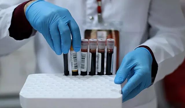 Uzun COVID Hastalarının Kanında Garip Yapılar Keşfedildi