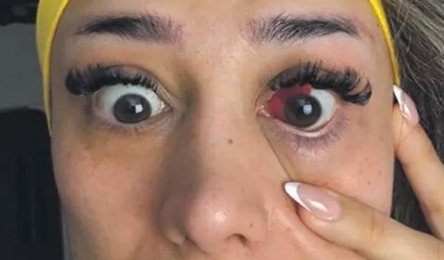 Fitness Eğitmeni Tavuk Döner Yedi! Gözü Bu Hale Geldi