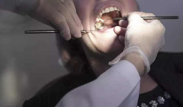 Kök Kanal Tedavisi Diyabete Çare mi? Şeker Kontrolü İyileşiyor