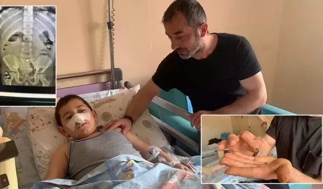 Batman’da 3 Mıknatıs Yutan Faruk Ameliyatla Sağlığına Kavuştu