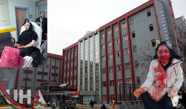 Boşanma Sürecindeki Eşine Kaldırım Taşıyla Saldıran Şüpheli Tutuklandı