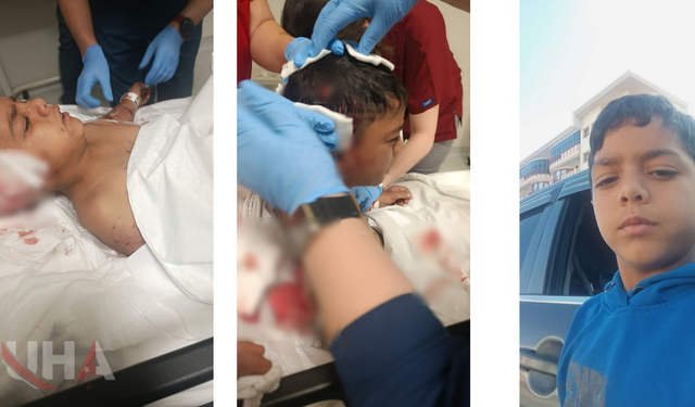 Davut, Okul Çıkışı Sokak Köpeklerinin Saldırısına Uğradı