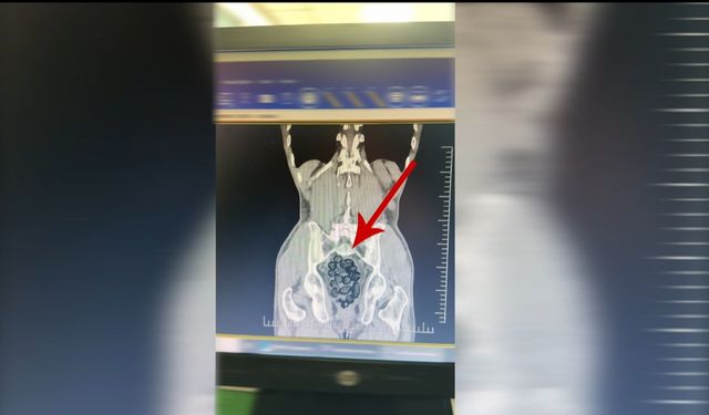 Yolcunun Midesinde 472 Gram Metamfetamin Bulundu