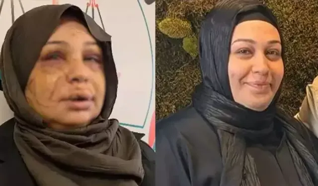 Eşini Yaralayan Polis Memurunun Dosyası Ağır Cezaya Gönderildi