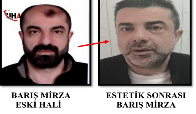 Yüzünü Değiştirdi, Kaderini Değiştiremedi: Firari Yakalandı