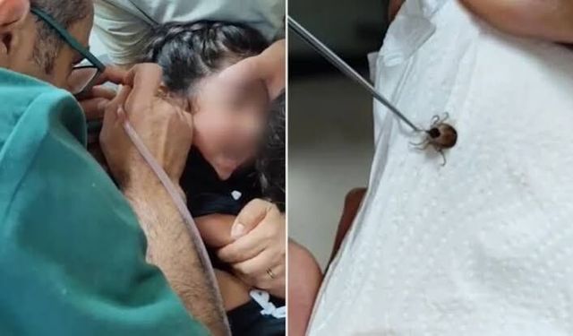 Kulak Ağrısının Nedeni Şok Etti! 5 Yaşındaki Çocuğun Kulağından Kene Çıktı