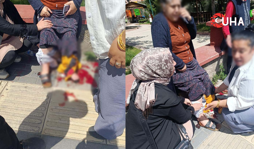 Husumetlilerin Silahlı Kavgasında Yoldan Geçen Kadın Bacağından Vuruldu