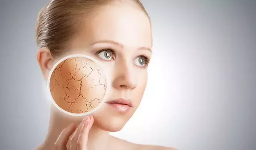 Uzmanlar Açıkladı: Kışın Cilt Kuruluğunun Nedeni