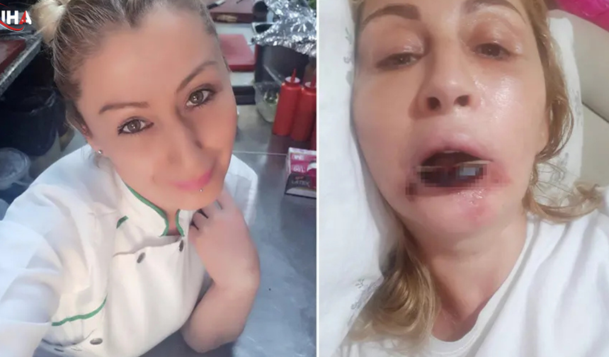 Estetik Operasyon Mağduriyeti: Songül Uzunoğlu'nun 7 Yıllık Adalet Arayışı