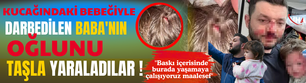 Kucağındaki Bebeğiyle Darbedilen Baba'nın Oğlunu Taşla Yaraladılar