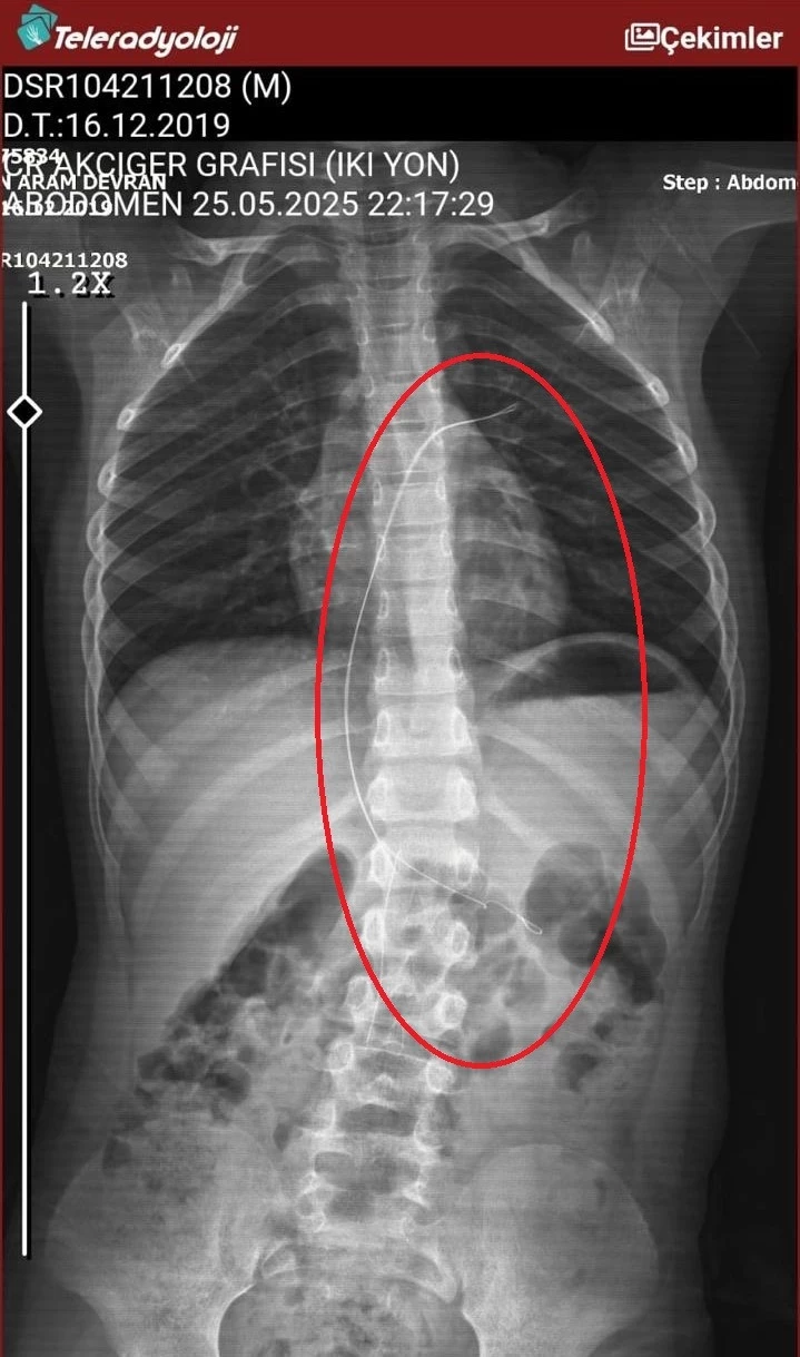Salatalik Yutunca Rahatsizlandi 3 Y Z4Wq