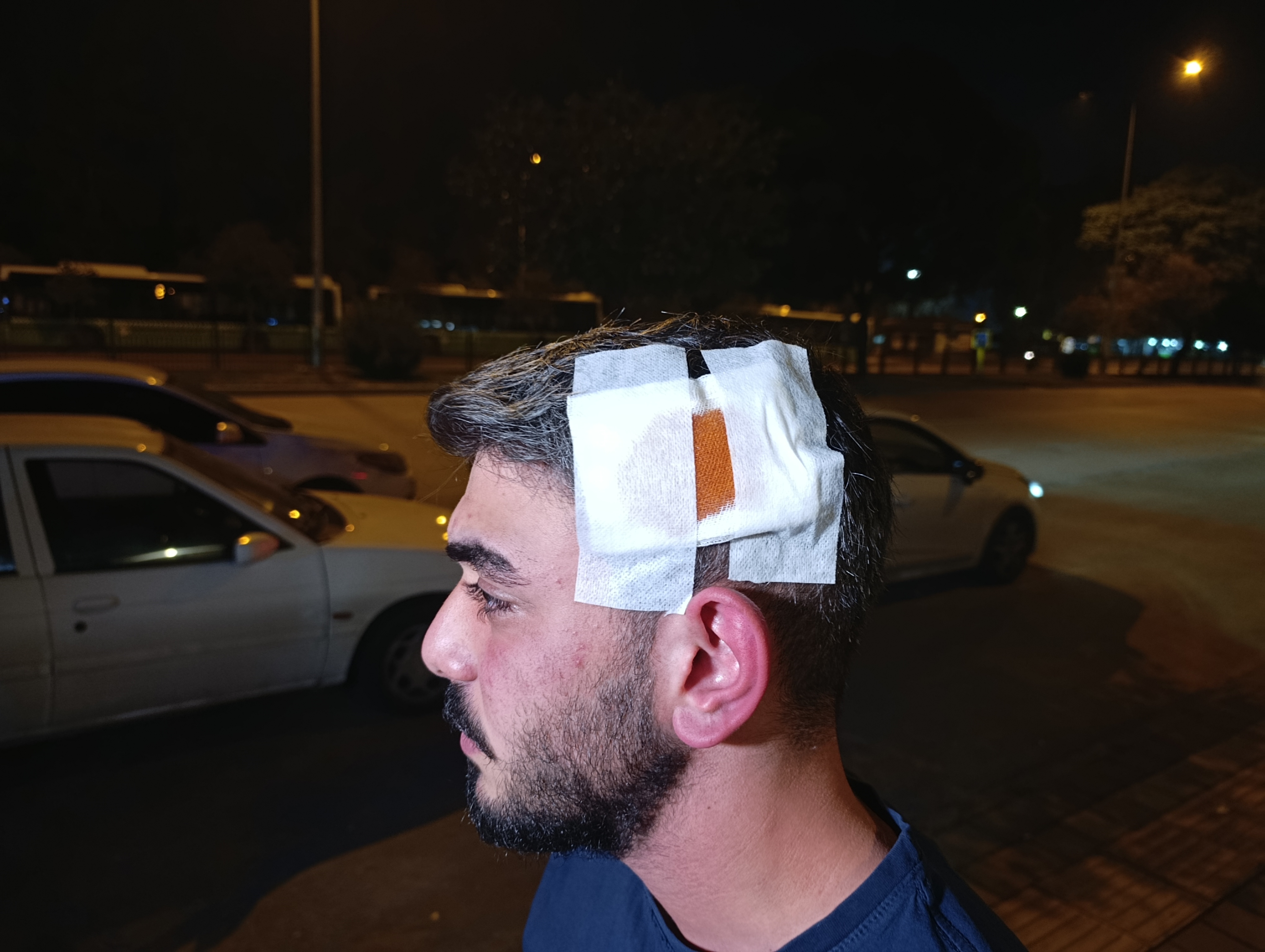 I K I A Y A R A Y L A K O M S U L A R I T A R A F I N D A N D A R B E 1046024 309873