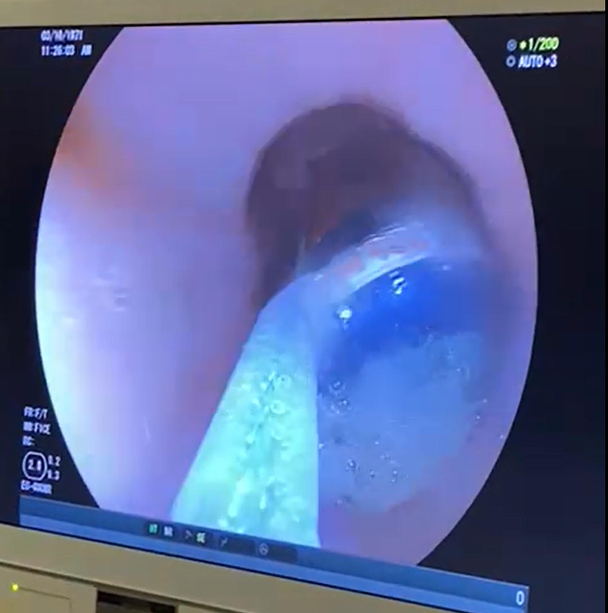 M I D E S I N D E K I 9 P I L E N D O S K O P I K Y O N T E M L E C 1080755 320791