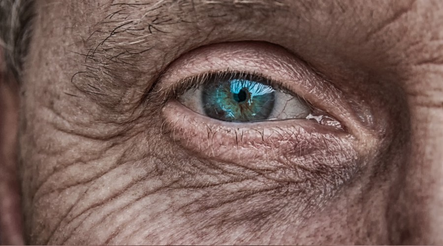 Cilt Yaslanmasi Onlenebilir H1368451 11