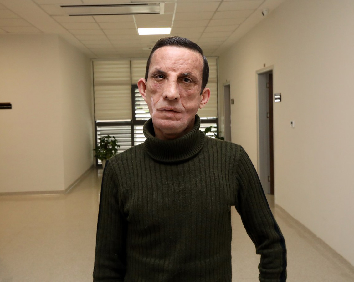 I L K Y U Z N A K I L L I U G U R A C A R H A Y A T A 14 Y I L 1130632 335695