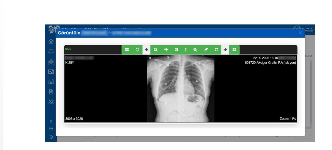 S A G L I K B A K A N L I G I A K C I G E R G O R U N T U L E M E S 1101632 327006