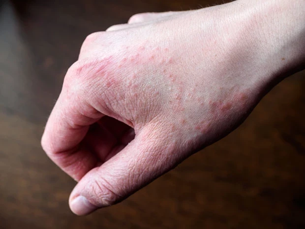 5Efd68A045D2A04258B869Ca