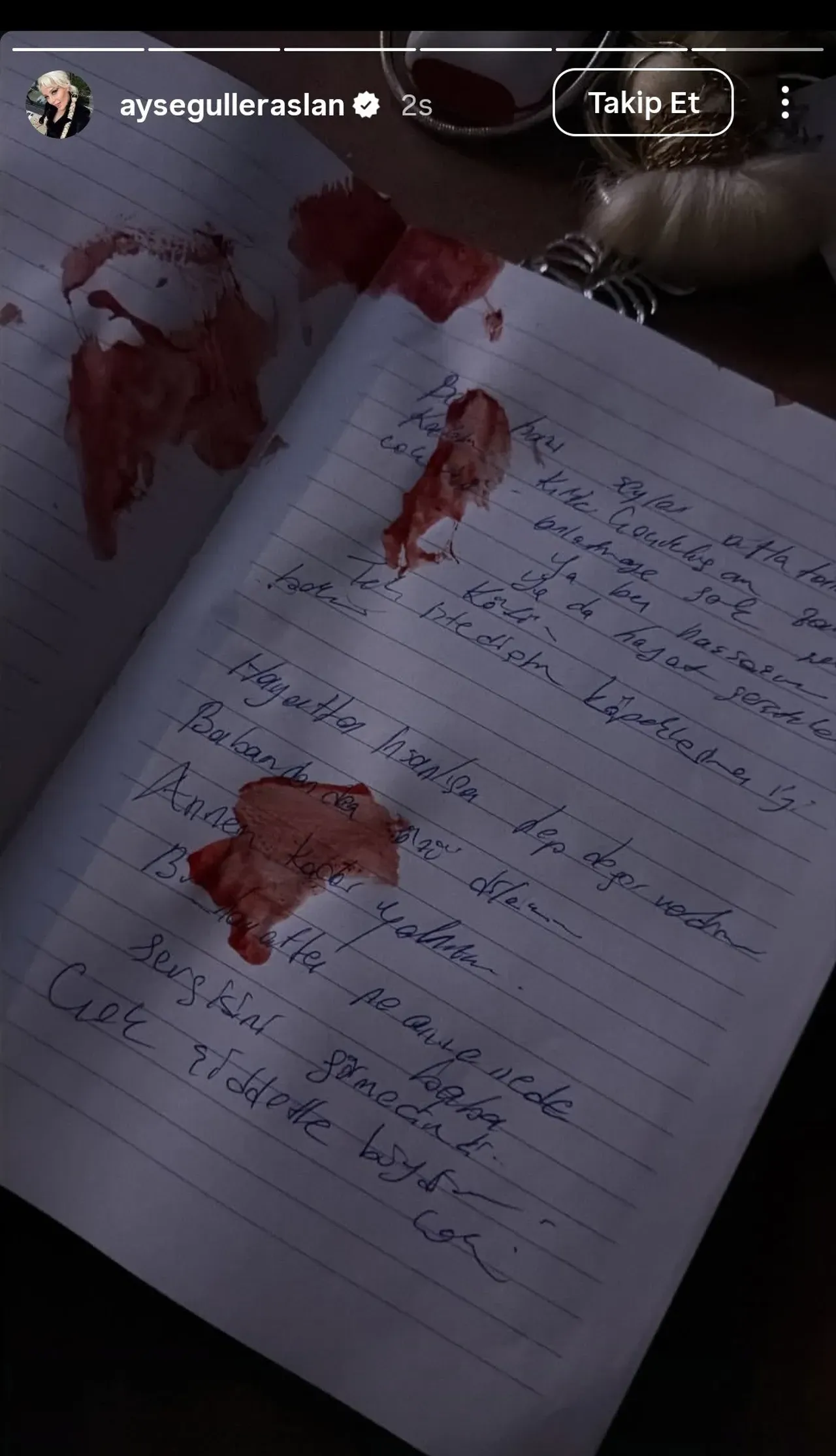 Aysegul Eraslan Intihar Mi Etti Iste Benim Stilim Ile Adini Duyurmustu Kanli Paylasim 1776789 202603130507 20260313050739 1